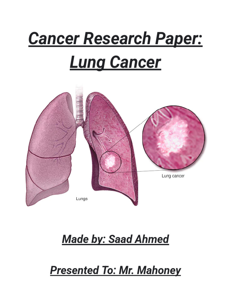 Cancer Research Paper_ Lung Cancer | PDF | Lung Cancer | Cancer