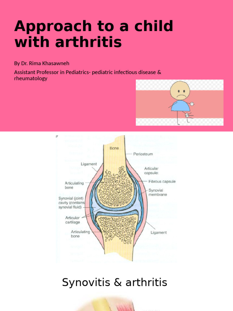 6th Yr- Approach to Arthritis | PDF | Inflammatory Bowel Disease ...