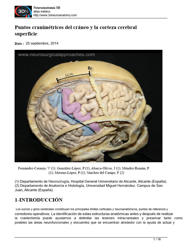 Puntos craniométricos del cráneo y la superficie cortical cerebral ...