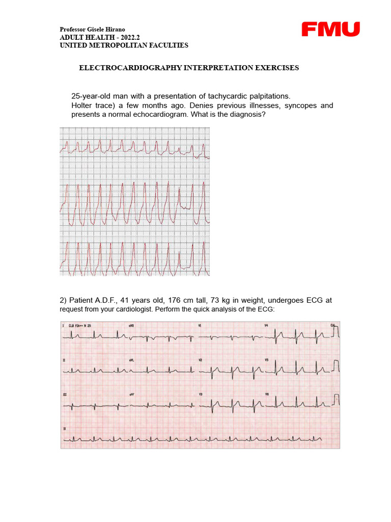 ECG Interpretation Exercises for Nurses | PDF | Electrocardiography ...