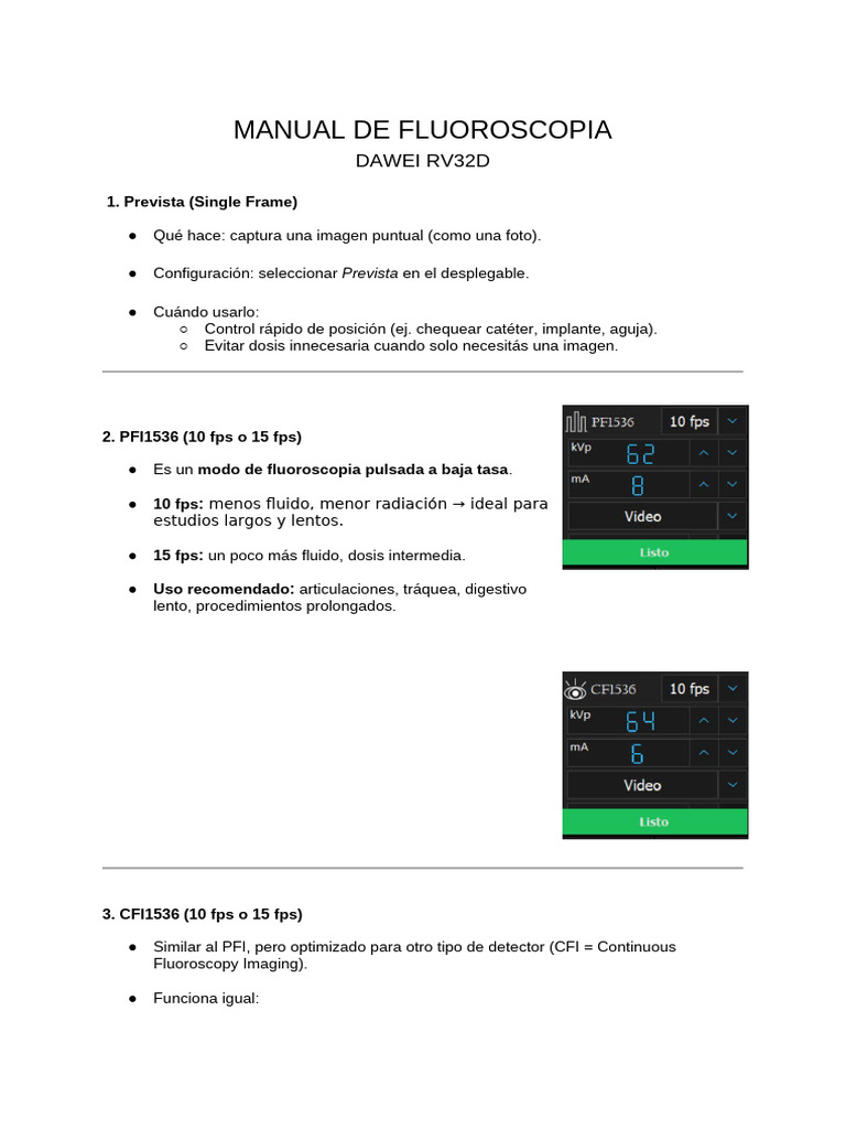 Guía de Modos de Fluoroscopia DAWEI RV32D | PDF | Cuadros por segundo