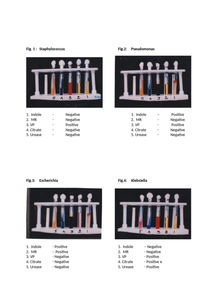 Bacterial Identification and Sensitivity Tests | PDF