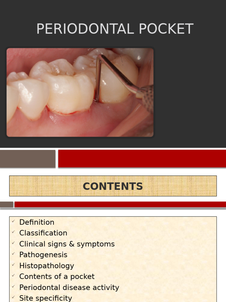 Pocket | PDF | Periodontology | Dentistry Branches