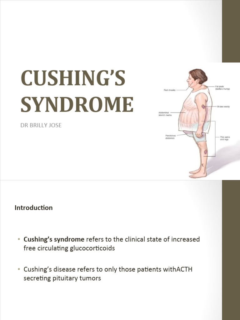 Cushing's Syndrome Overview and Management | PDF | Clinical Medicine ...