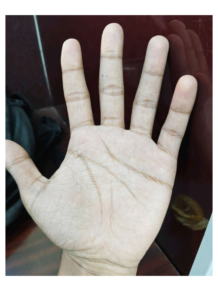 Structure of Hand Lines | PDF