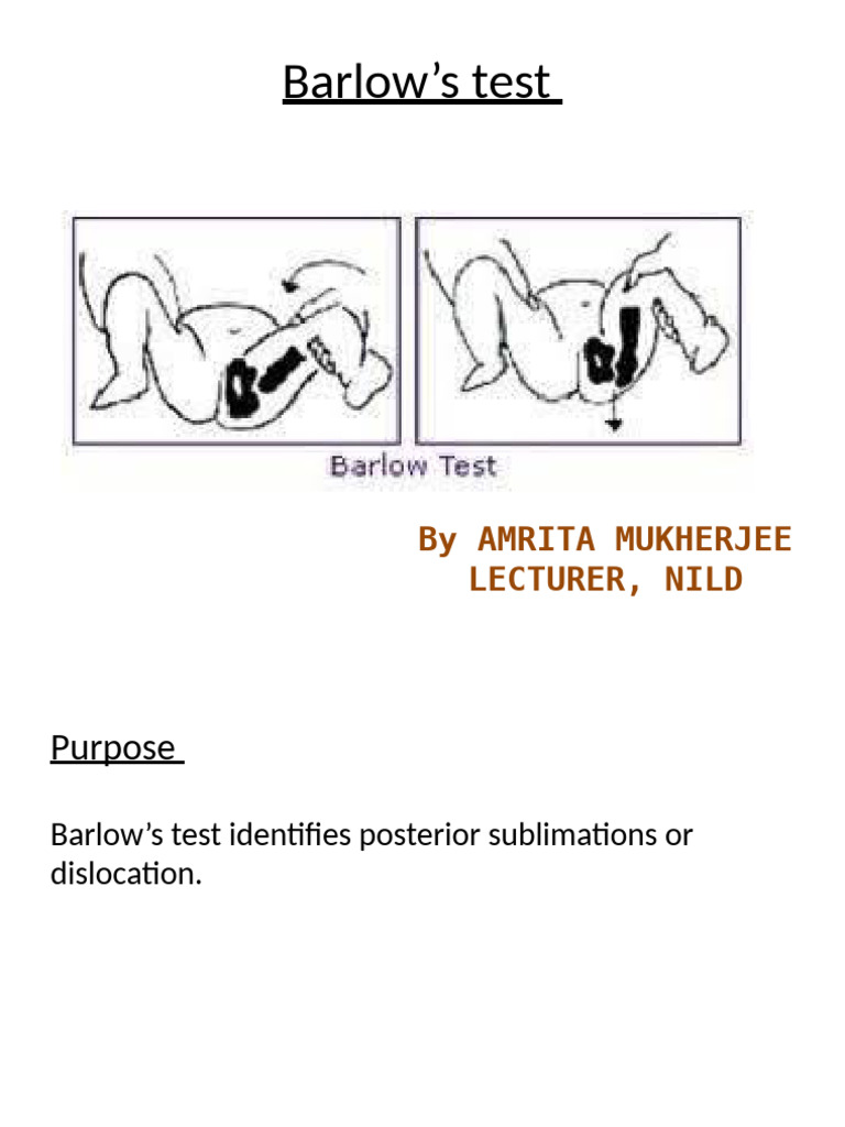 BARLOW'S TEST | PDF