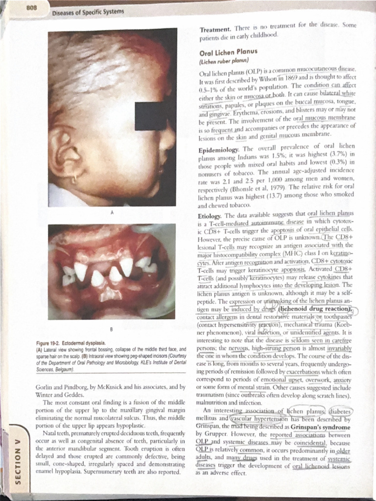 Olp | PDF