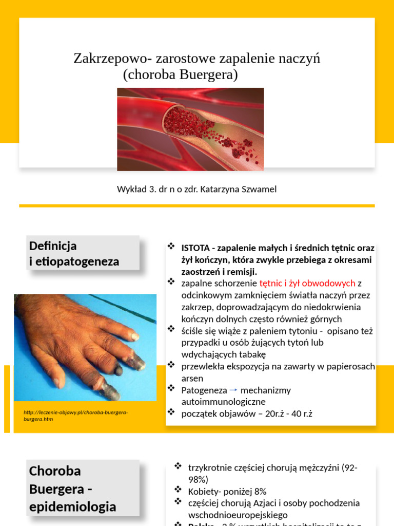 wyk-ad-4-zakrzepowo-zarostowe-zapalenie-naczy-pdf