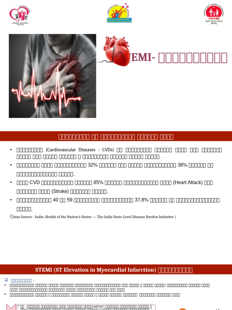 Stemi JD | PDF