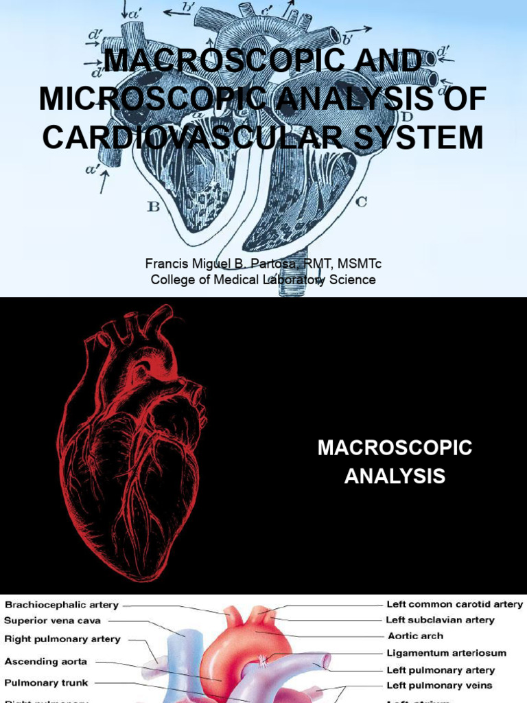 Cardiovascular System Analysis Guide | PDF | Coronary Circulation | Aorta