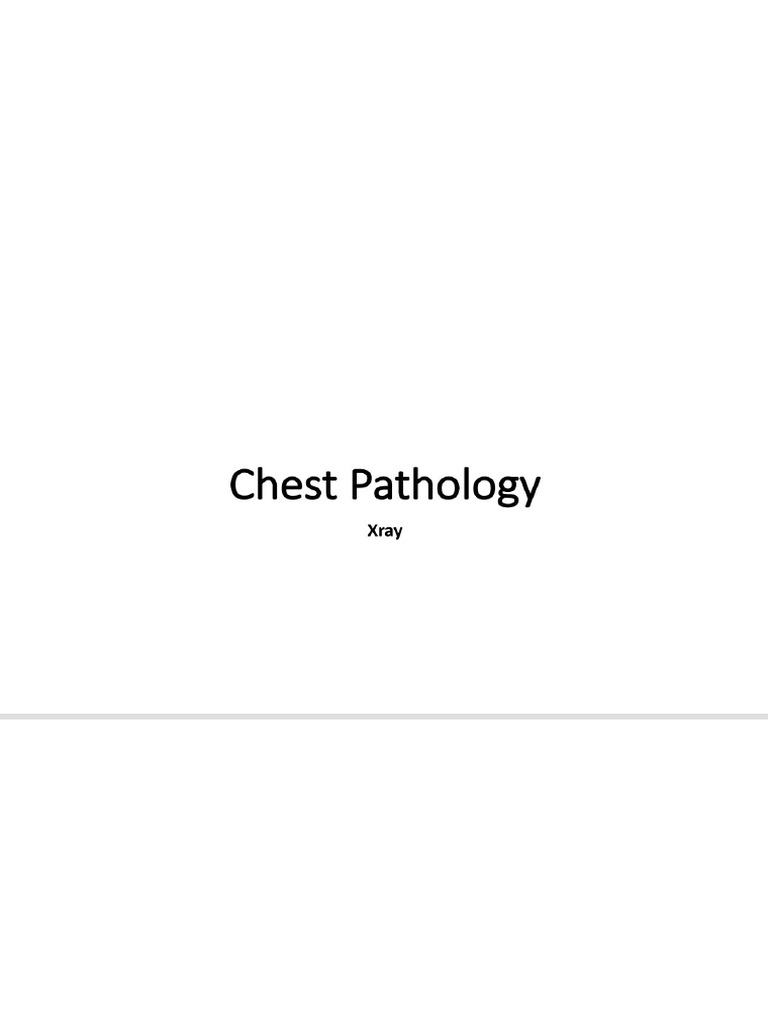 Radio Diagnosis Chest Pathology | PDF