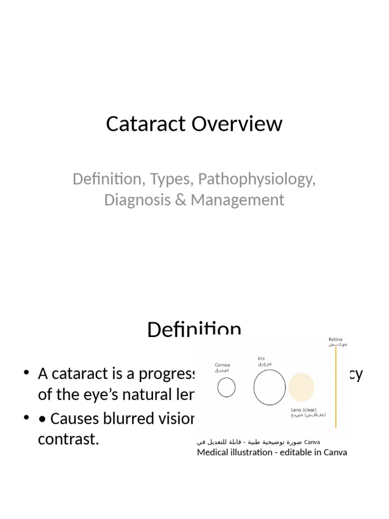 Comprehensive Cataract Guide: Types & Treatment | PDF