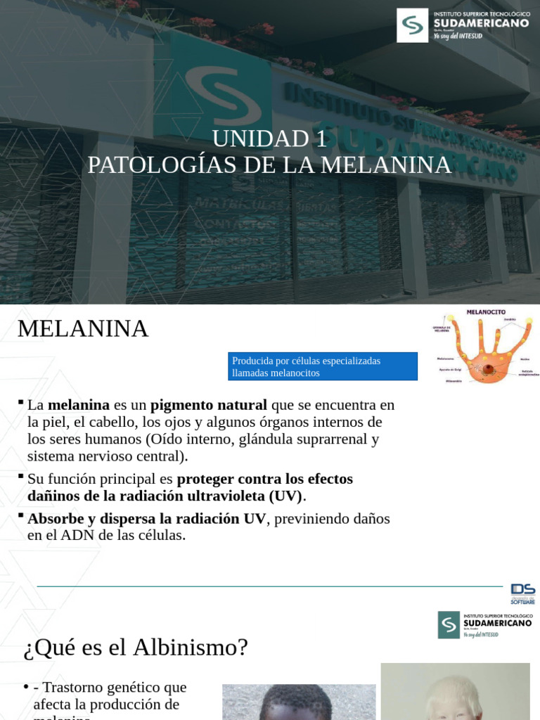 Albinism o | PDF
