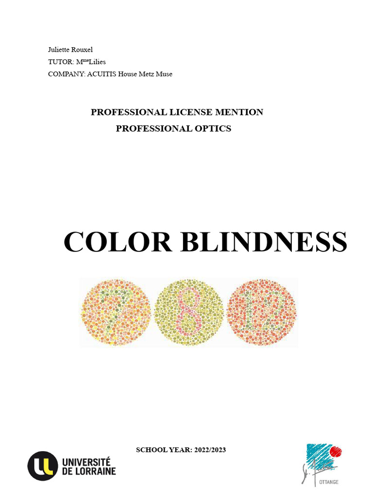 Understanding Color Blindness: A Study | PDF | Retina | Color