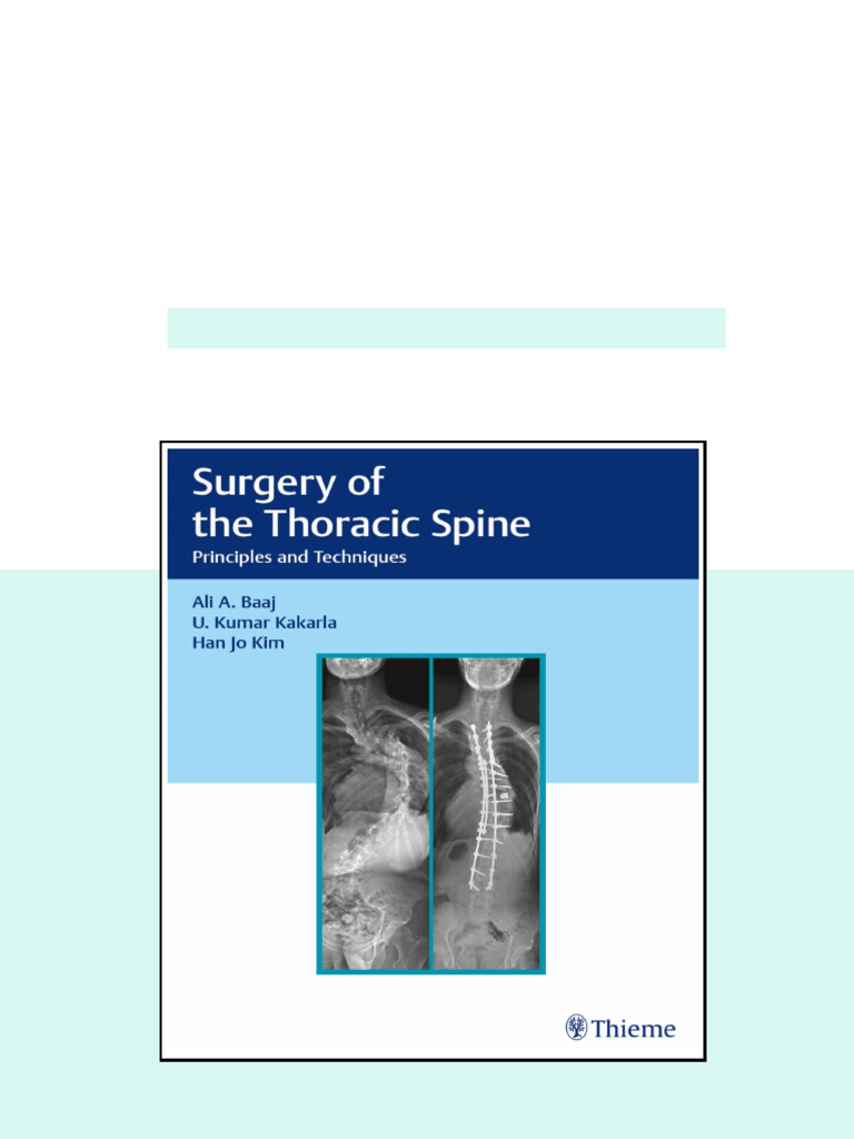 Thieme Surgery of the Thoracic Spine Principles and Techniques Complete ...