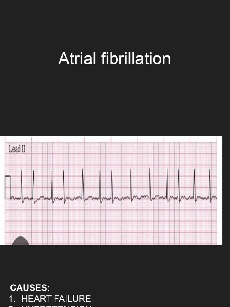 A Fib | PDF