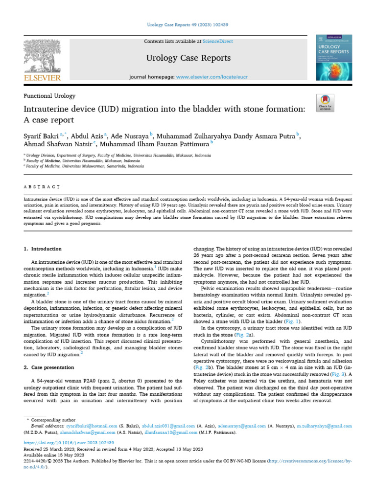 Intrauterine Device IUD Migration Into the Bladder | PDF | Urology ...