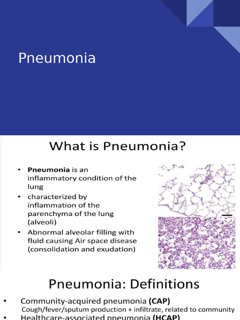 15 Pneumonia | PDF