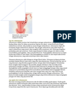 Adenomyosis