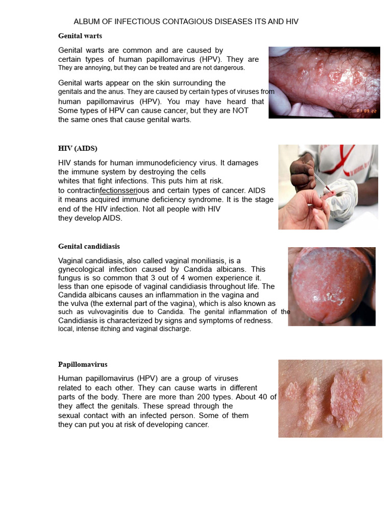 Overview of Common STDs and Infections | PDF | Sexually Transmitted ...