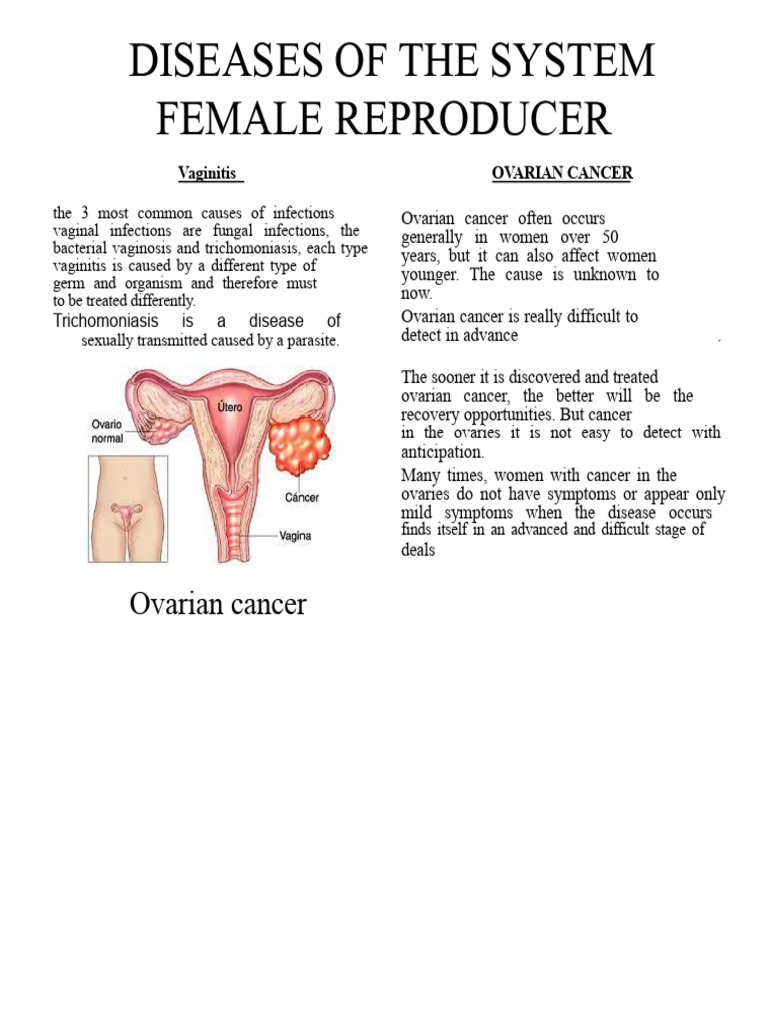 Diseases of the Female Reproductive System | PDF