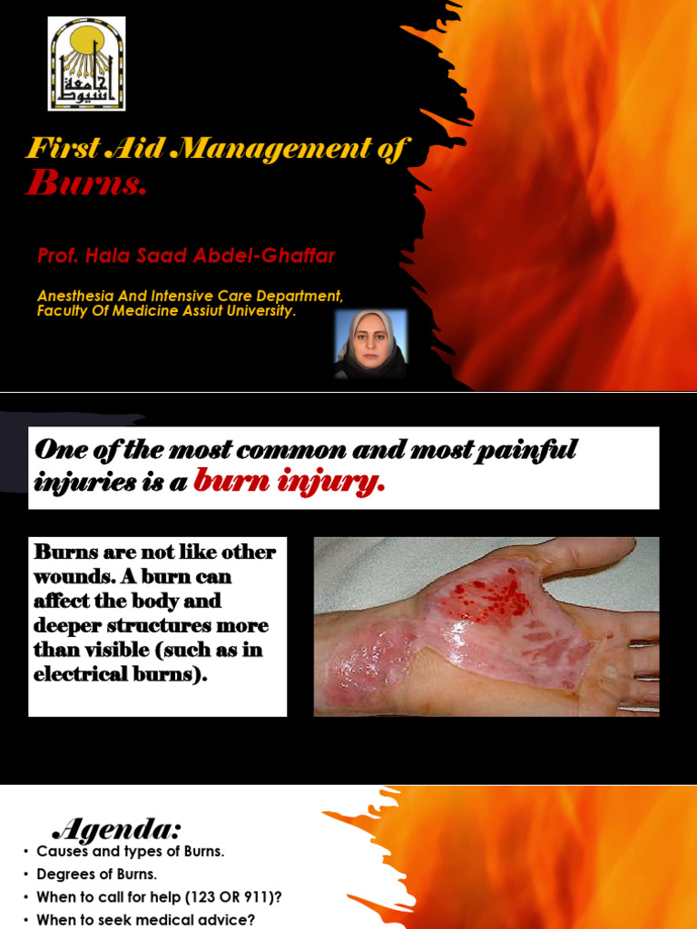 First Aid for Burn Injuries Guide | PDF | Burn | Diseases And Disorders