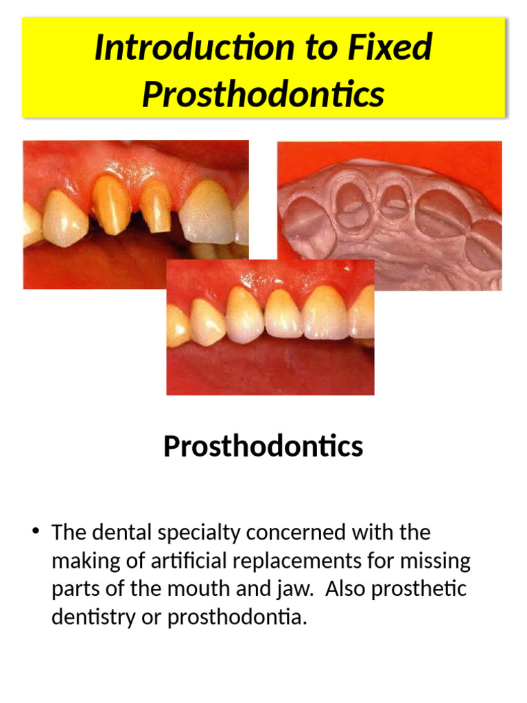 Fixed Prosthodontics Overview Guide | PDF | Dental Anatomy | Dentistry