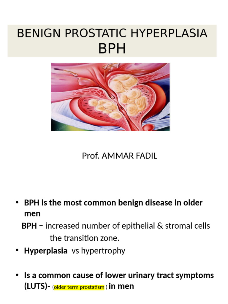 Understanding Benign Prostatic Hyperplasia | PDF | Prostate | Prostate ...