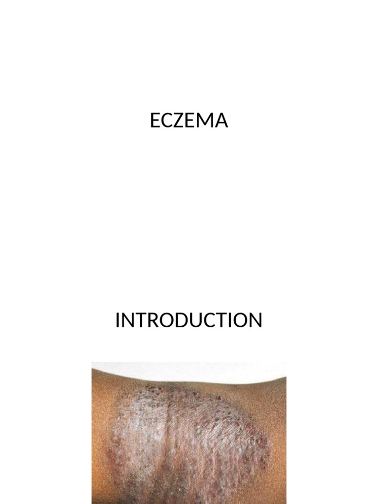 Understanding Eczema: Types and Treatment | PDF | Dermatitis | Dermatology