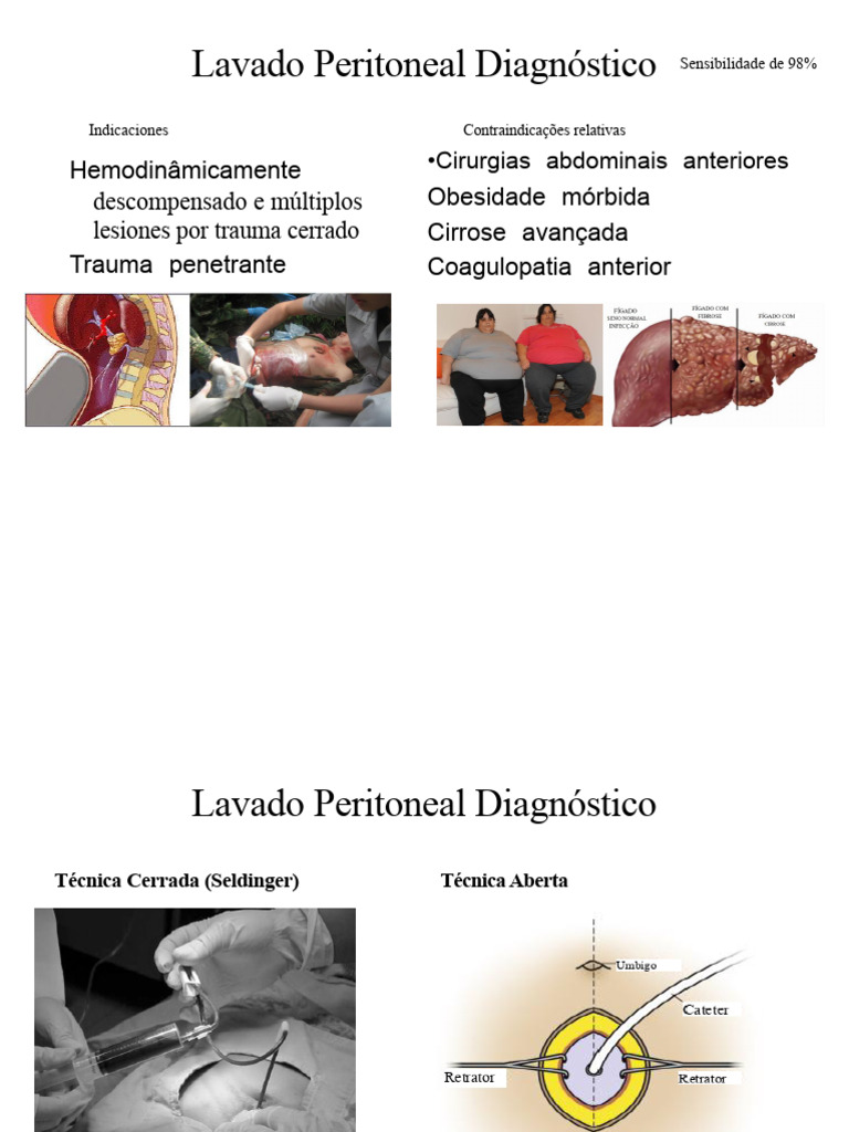 Lavado Peritoneal Diagnóstico e Indicações | PDF | Medicina Clínica ...