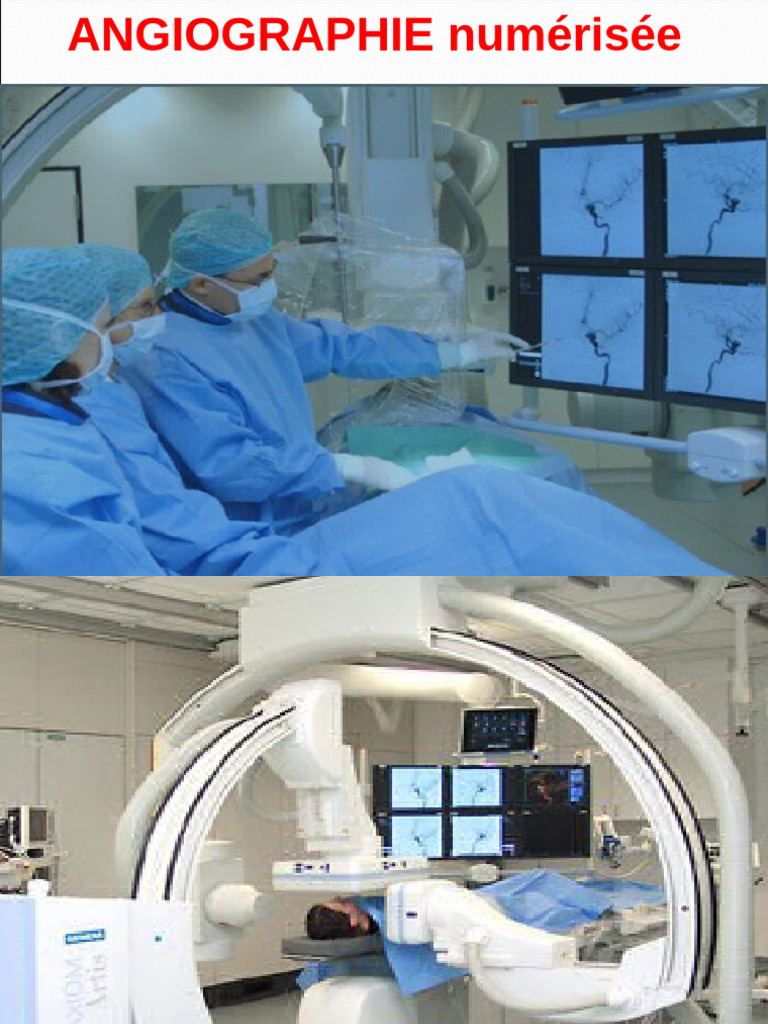 Angiographie numérisée : techniques et préparation | PDF | Angiographie ...