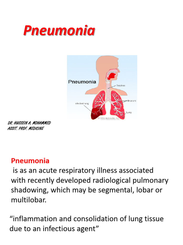 Day 8 Pneumonia | PDF | Pneumonia | Lung
