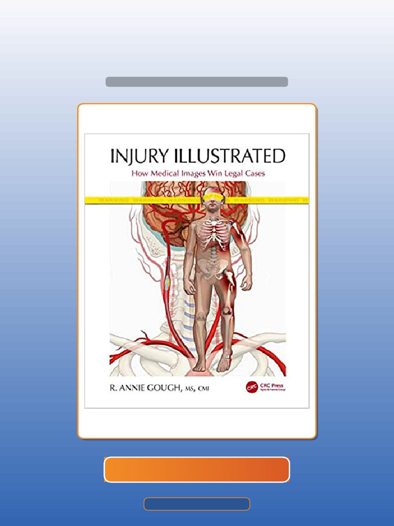 Test Bank of Injury Illustrated How Medical Images Win Legal Cases by R ...