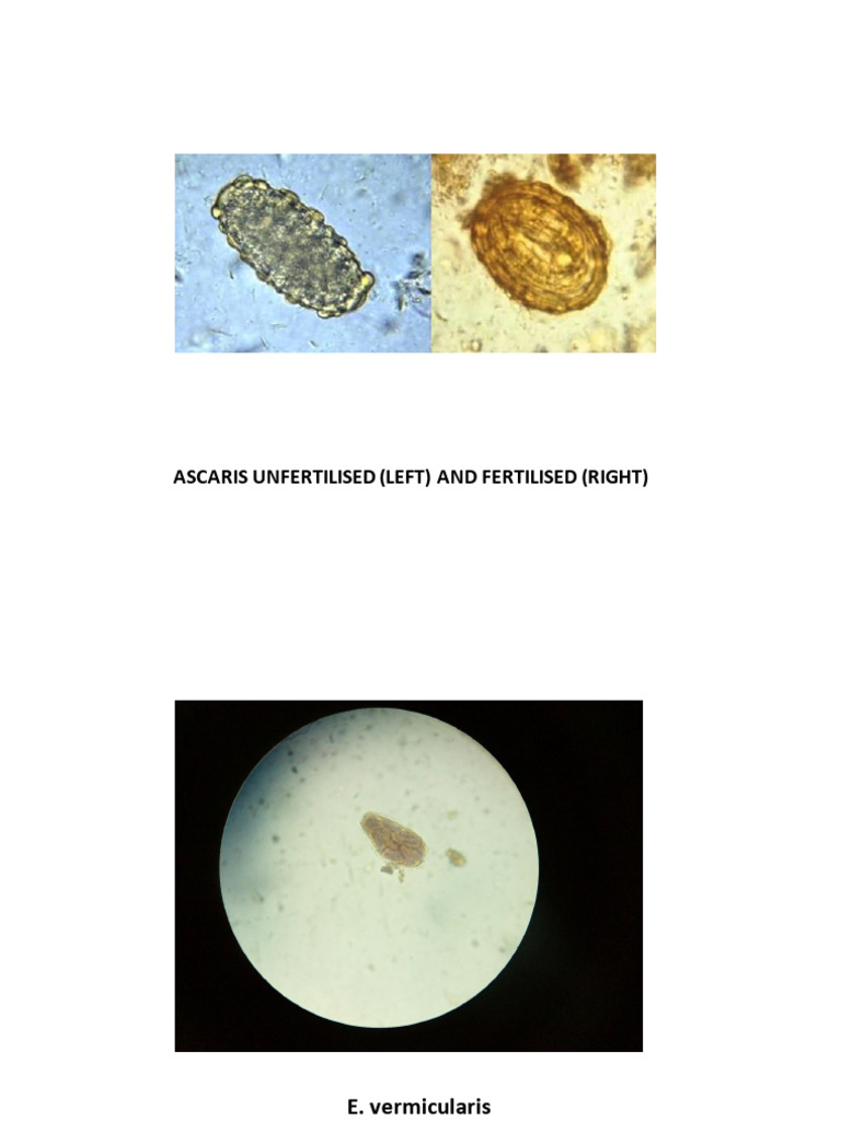 Stool | PDF