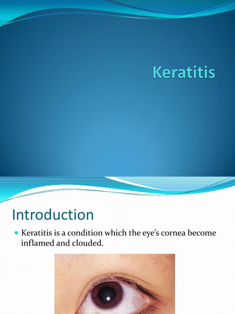 Keratitis PDF Ophthalmology Medical Specialties
