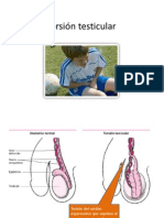 Torsión testicular.pptx