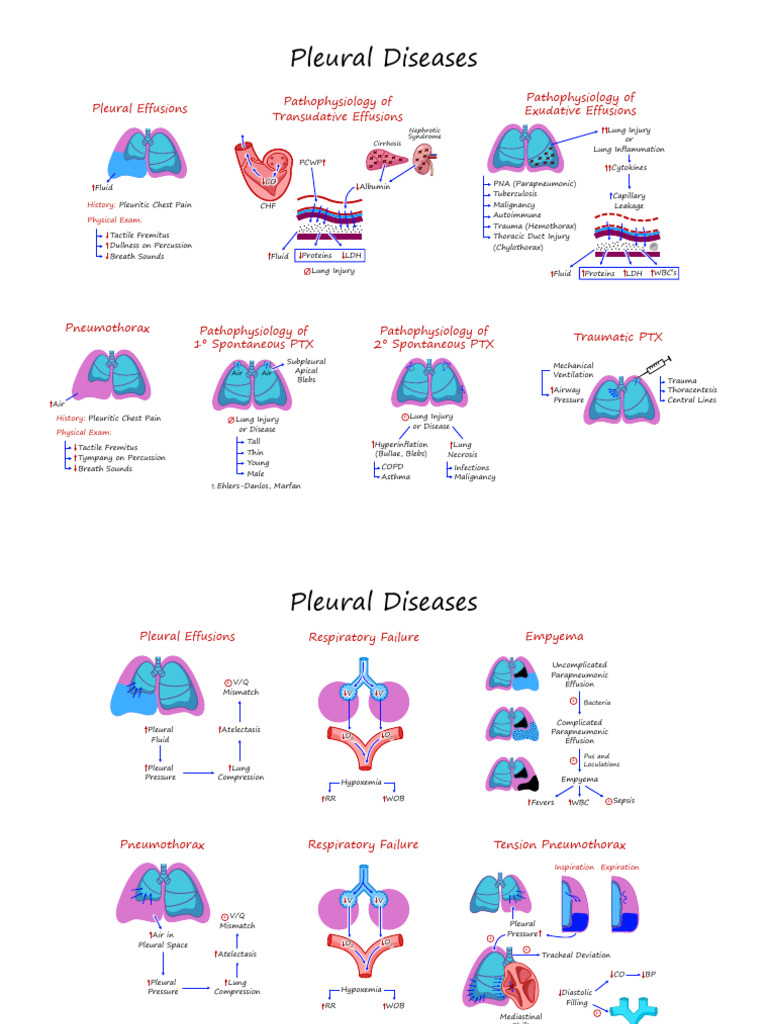 Understanding Pleural Diseases and Effusions | PDF | Lung | Respiratory ...