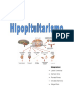 Hipopituitarismo