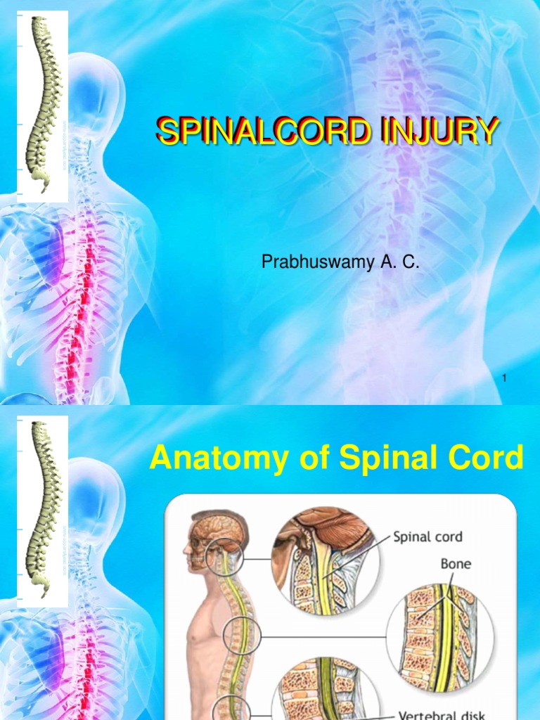Spinal Cord Injury Overview and Management | PDF | Spinal Cord Injury ...