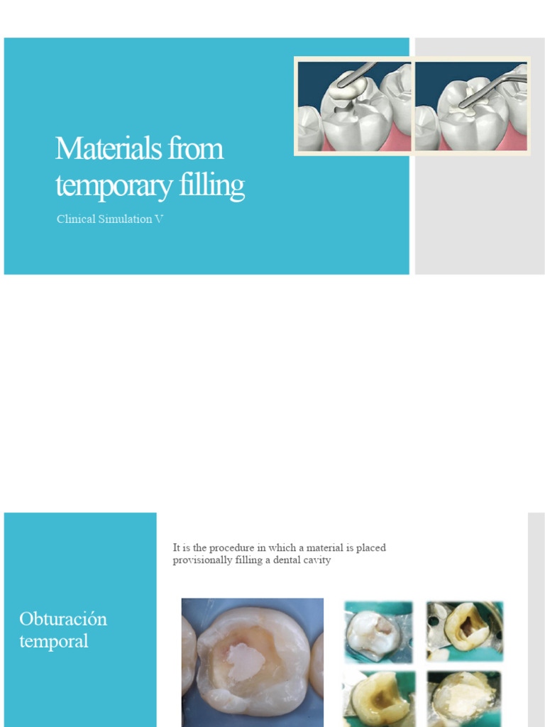 Temporary Dental Filling Materials Guide | PDF | Materials