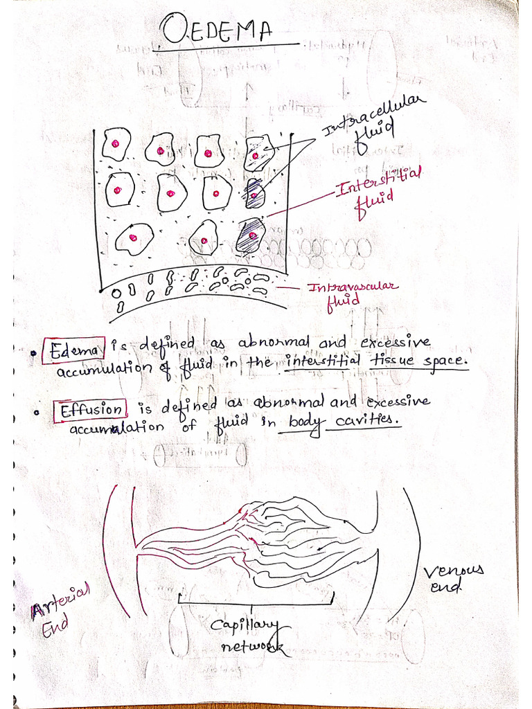 Edema | PDF