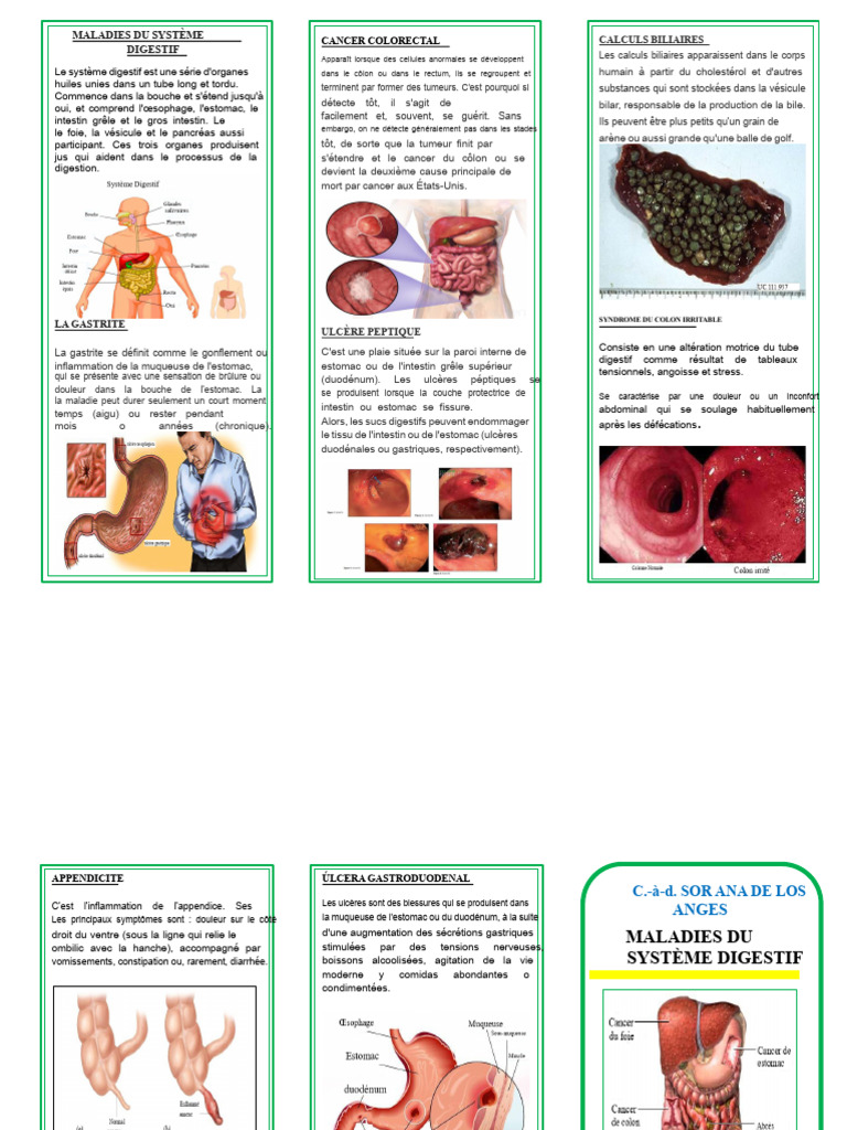 Maladies courantes du système digestif | PDF | Estomac | Tractus gastro ...