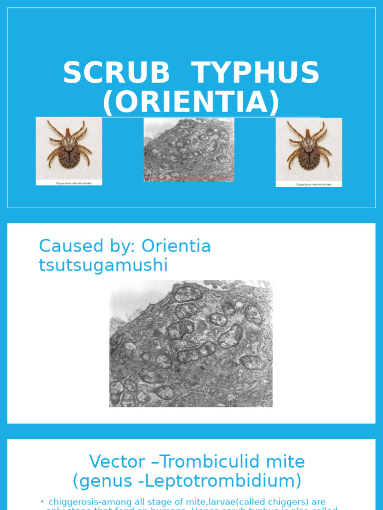 Scrub Typhus | PDF