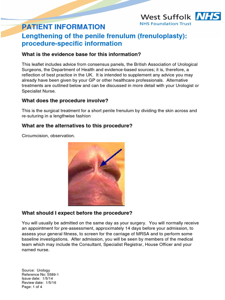 5589 1lengtheningofthepenilefrenulum (Frenuloplasty ...