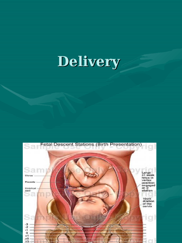 Delivery | PDF