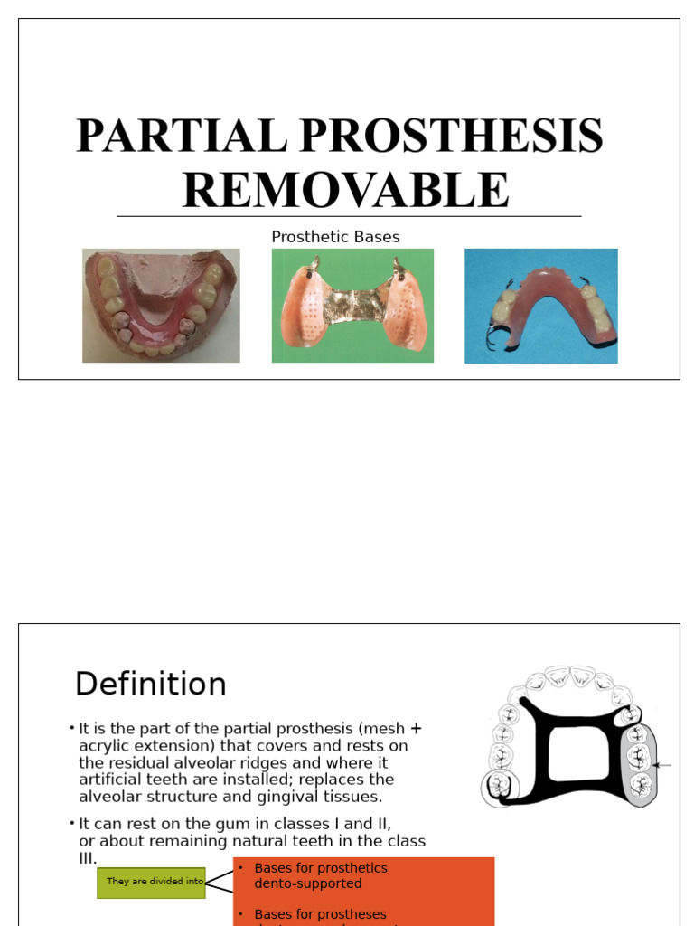 Removable Partial Denture Prosthetic Bases | PDF