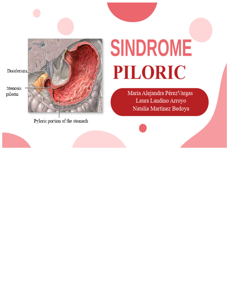 Pyloric Obstruction: Causes and Symptoms | PDF | Nausea | Stomach