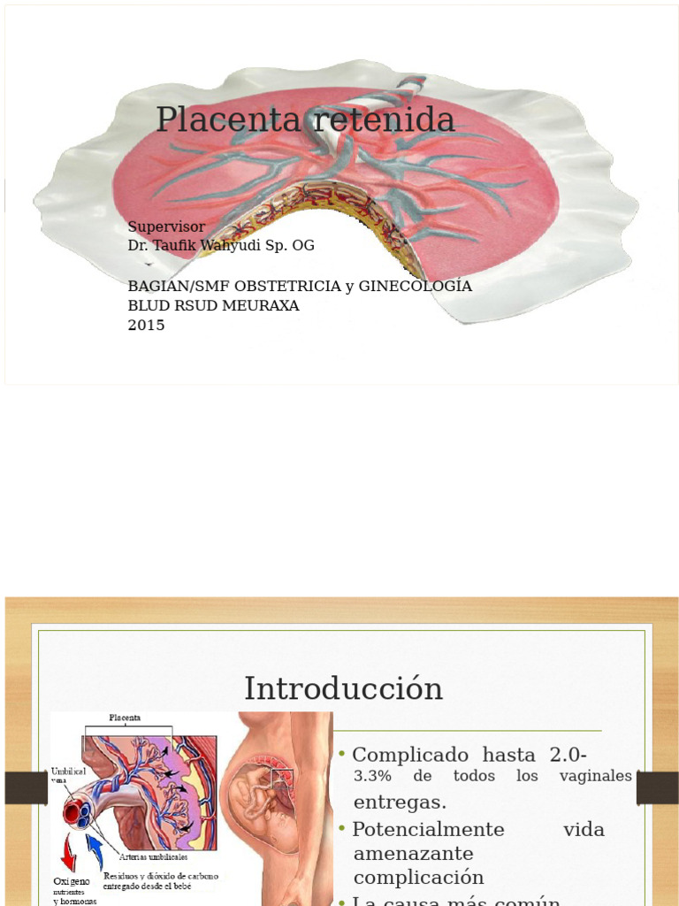 Placenta Retenida | PDF | Maternidad | Obstetricia