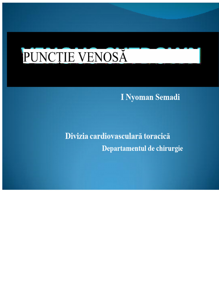 Cutdown Venos. | PDF