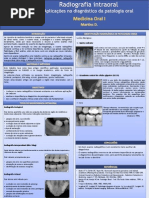 Radiografia intra-oral
